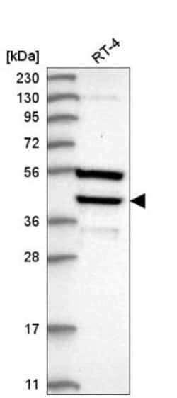 DEDD Antibody, Novus Biologicals 100 &mu;L | Buy Online | Novus Biologicals | Fisher Scientific